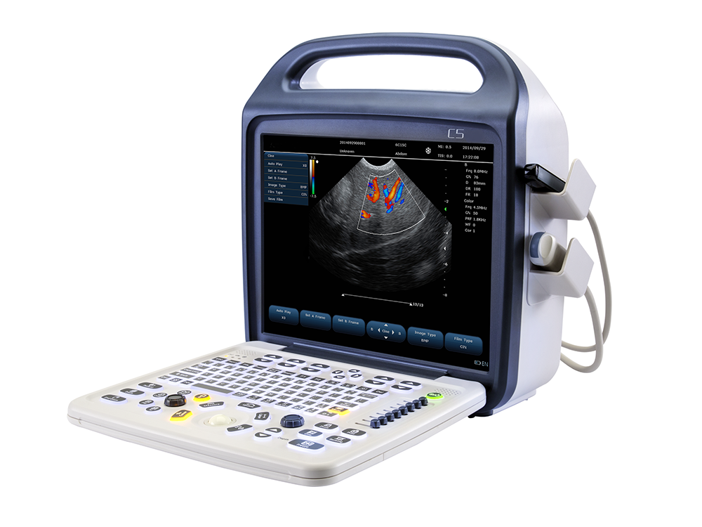 Portable Ultrasound